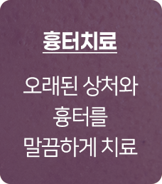 흉터치료, 엑스카,