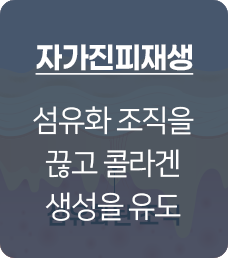 자가진피재생술