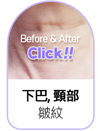 Button 4