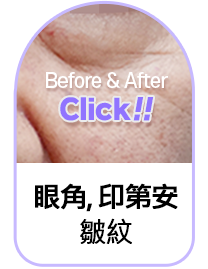 Button 2
