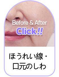 Button 3
