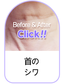 Button 4