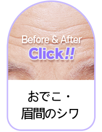 Button 1