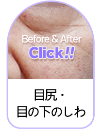 Button 2