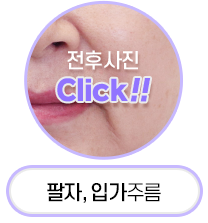 Button 3