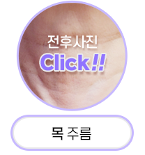 Button 4