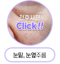 Button 2