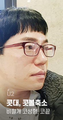 비수술 성형 휜 코 팔자주름 교정 ! #shorts