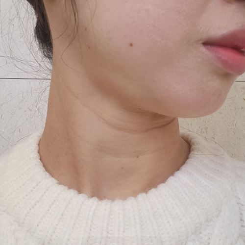 수술전