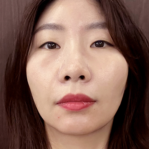 수술전