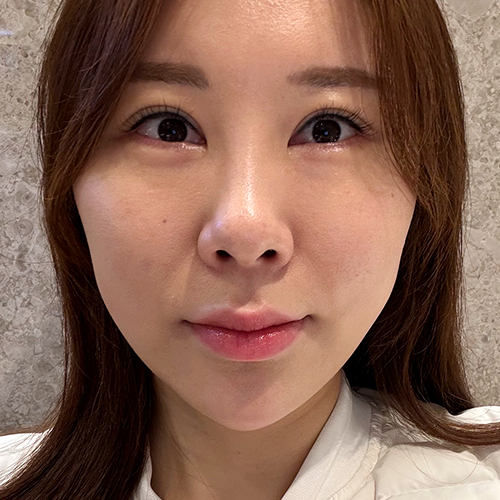 수술전