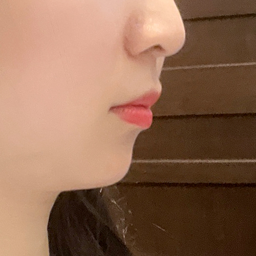 수술전