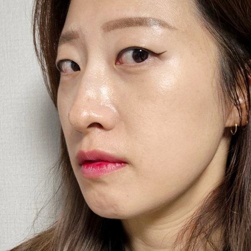 수술전